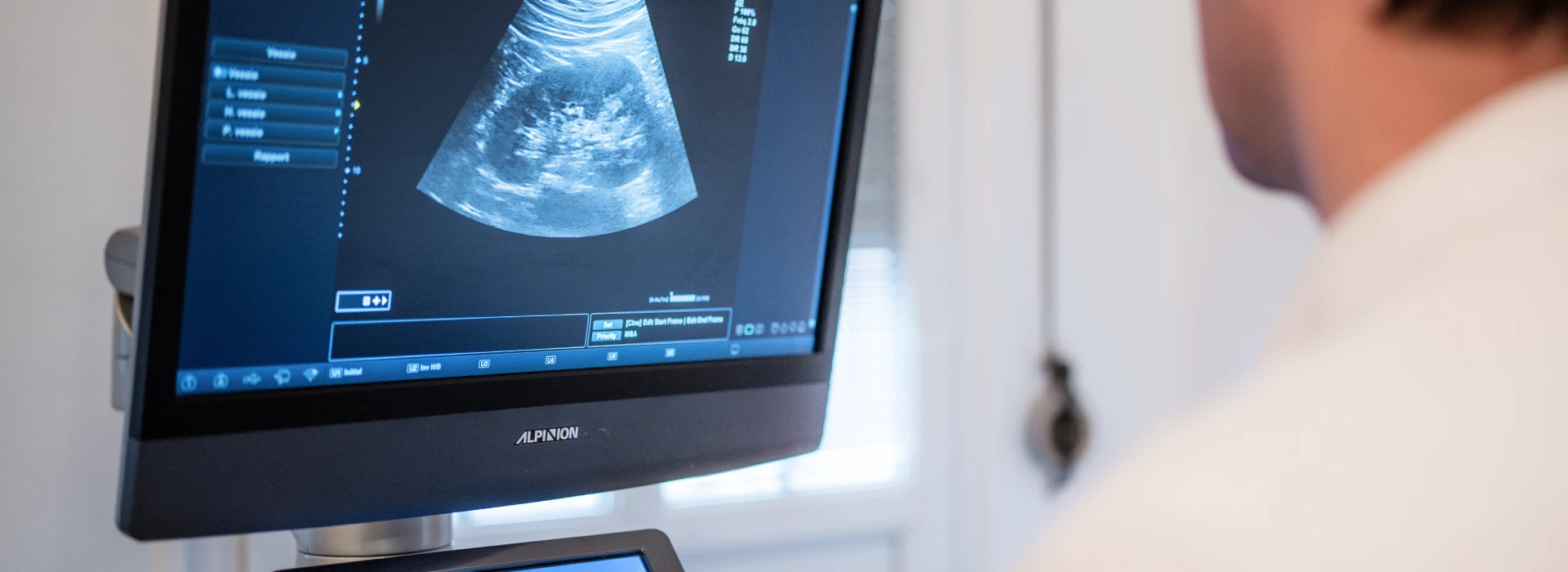 echographie au Cabinet d’urologie à Strasbourg